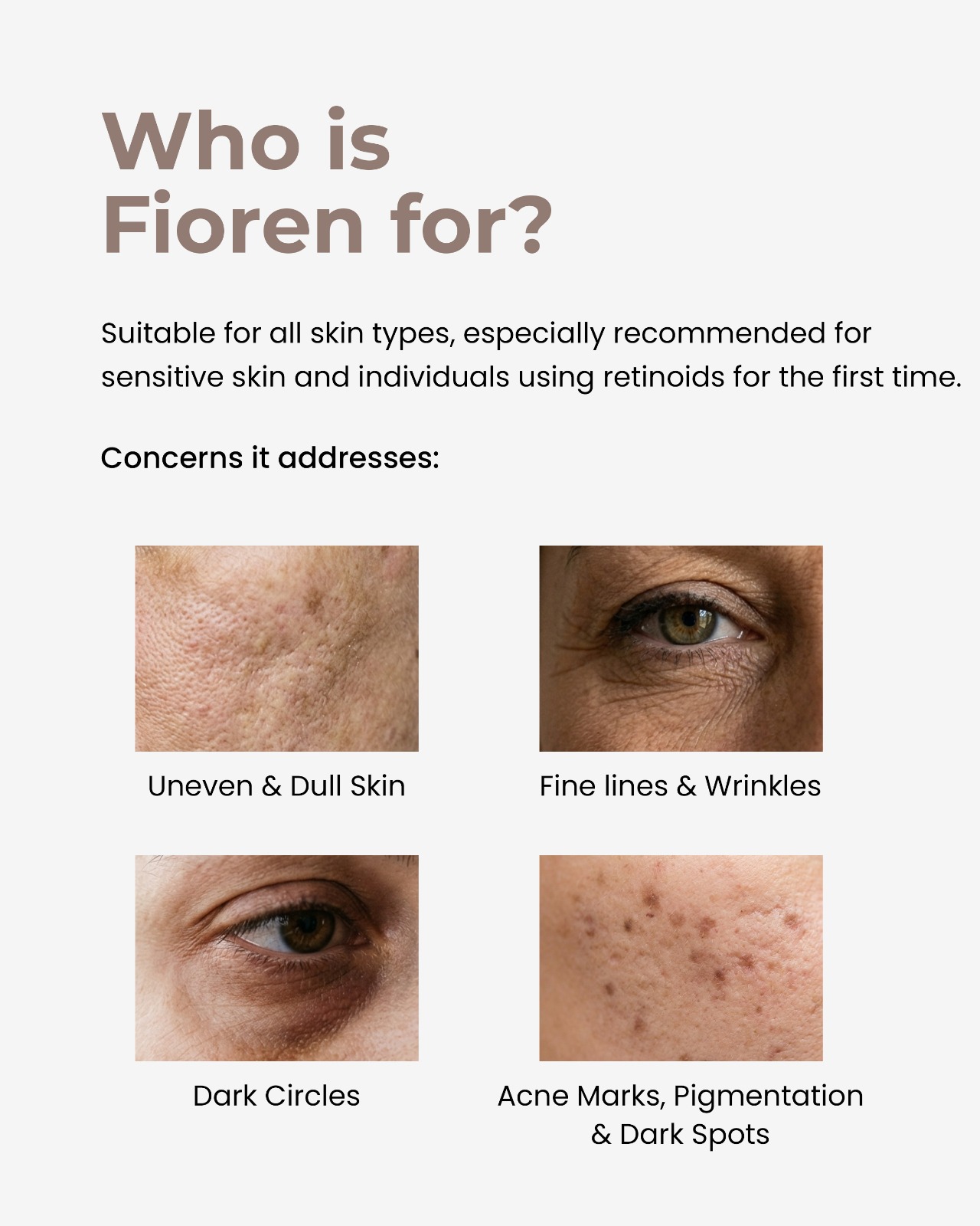 FIOREN 3